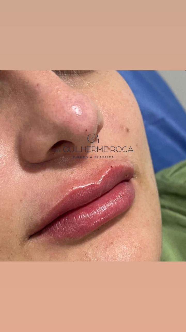 Cirurgião plástico | Dr. Guilherme Roca Romero