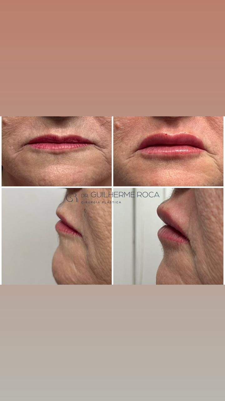 Cirurgião plástico | Dr. Guilherme Roca Romero