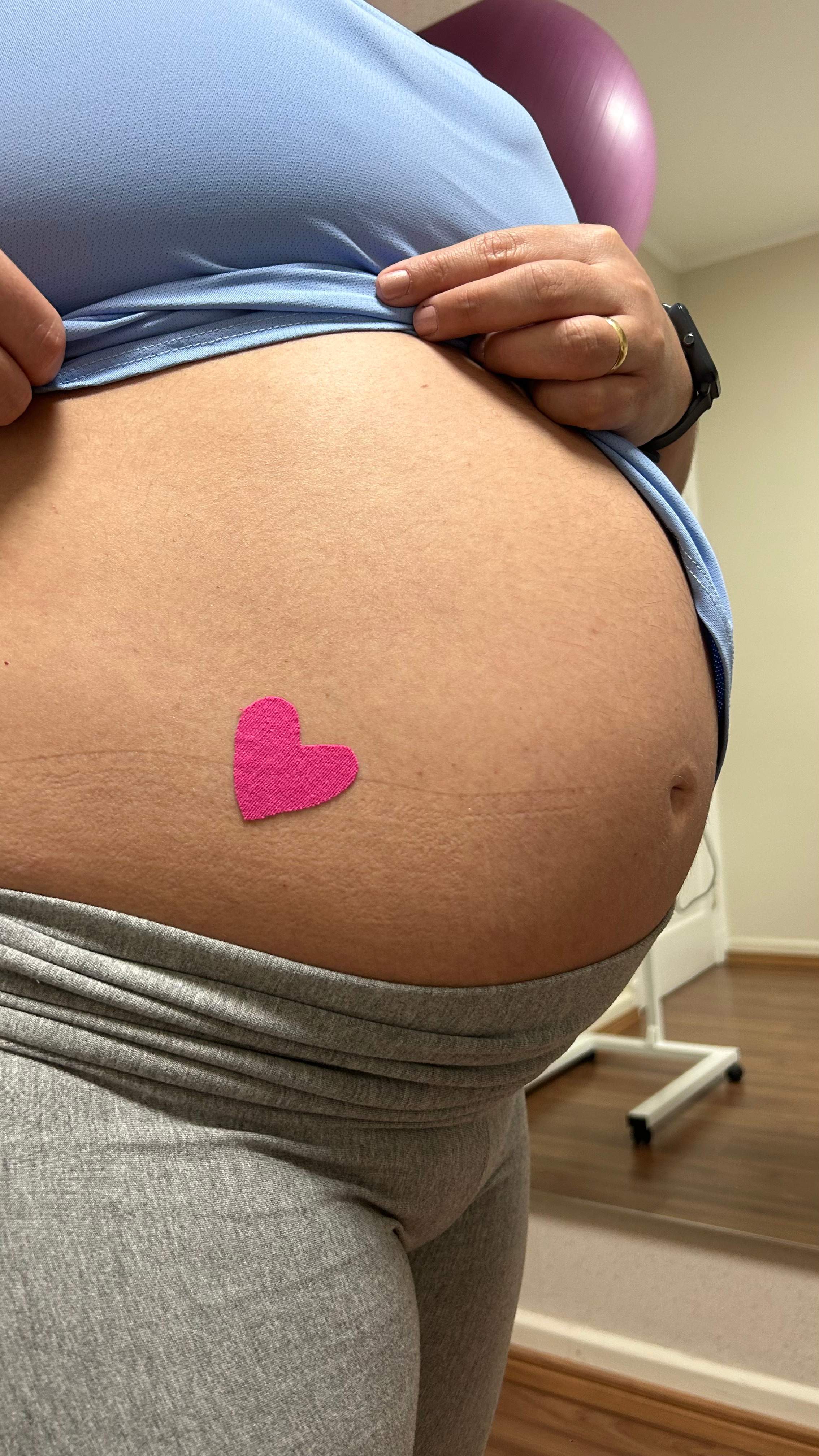 Pós Parto - Fisioterapia Pélvica - Obstetríca - Vila Mariana