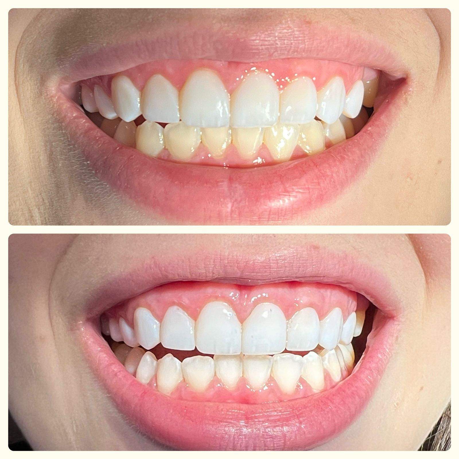 Dentista | Dr. Lucas Fiorante Cappellette