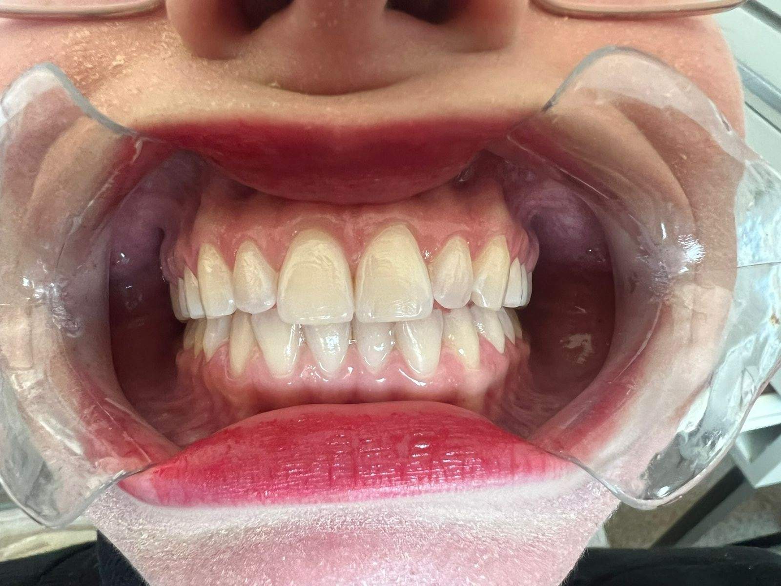 Ortodontista | Dr. Lucas Fiorante Cappellette