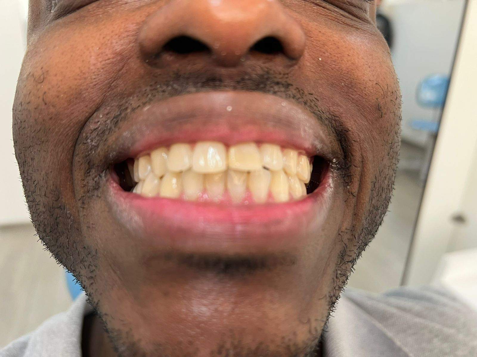 Cirurgião Dentista | Dr. Lucas Fiorante Cappellette