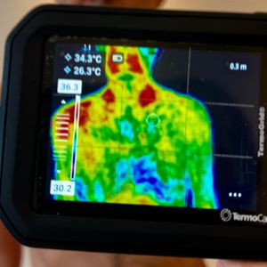 Exame de Termografia Clinica
