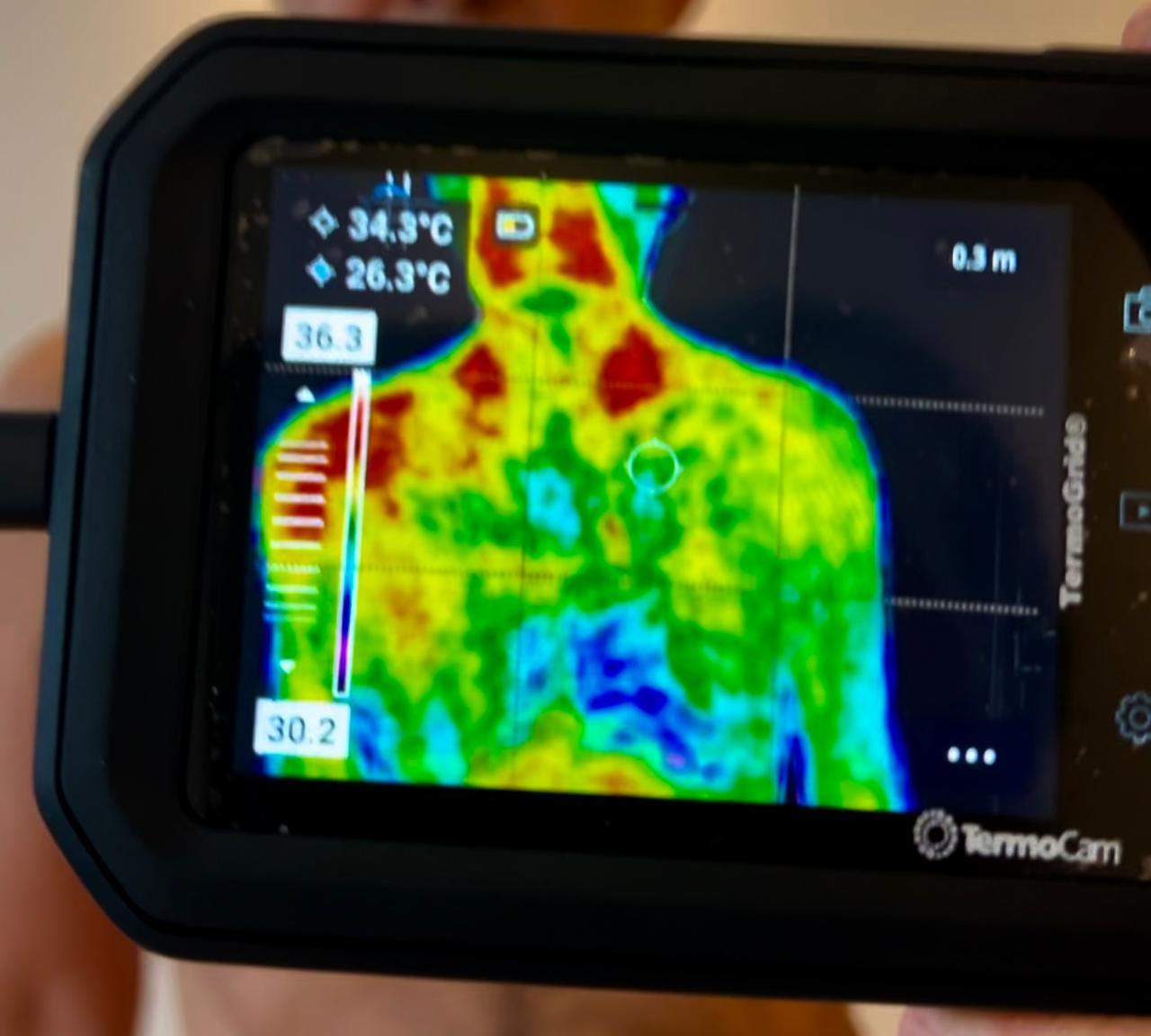 Exame de Termografia Clinica