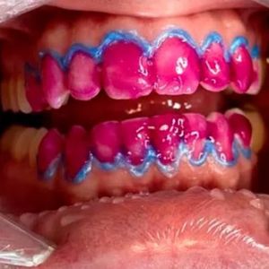 Dentista | Dr. Rafael Costa e Silva