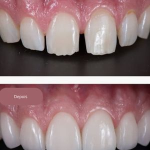 Dentista | Dr. Rafael Costa e Silva