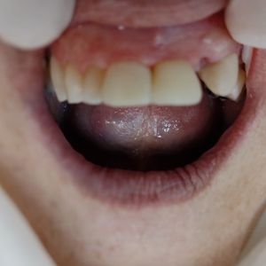 Dentista | Dr. Rafael Costa e Silva