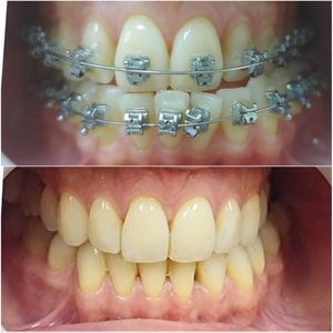 Dentista | Dra. Raisa Falkine