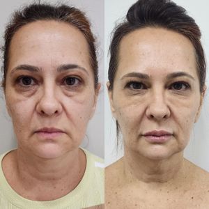 Dentista | Dra. Raisa Falkine