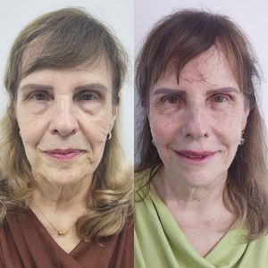 Dentista | Dra. Raisa Falkine